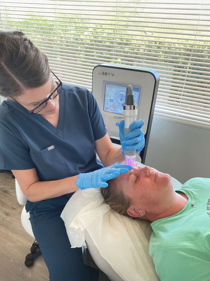 Heather Starks performing Vybe RF microneedling in Phoenix AZ