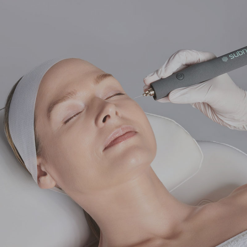 plasma pen image for treatment pricing page