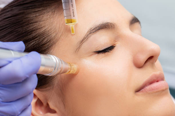 Non-Surgical Skin Tightening