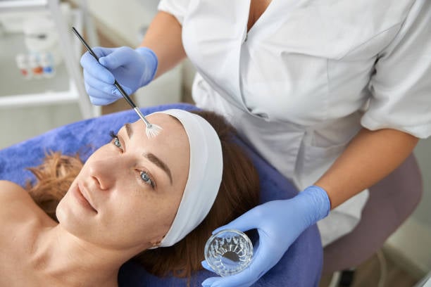 Chemical Peels in Phoenix AZ