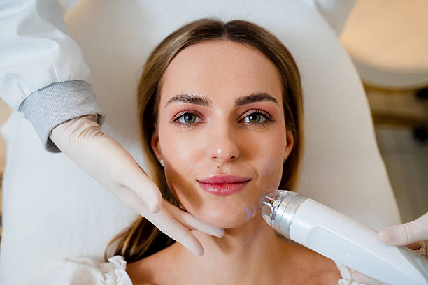 RF Microneedling Treatment