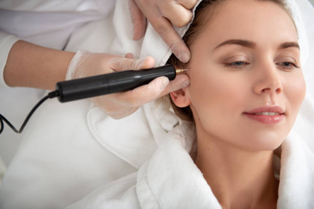 Subnovii Plasma Pen Treatments
