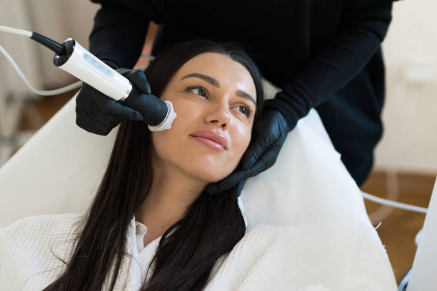 Vybe RF Microneedling