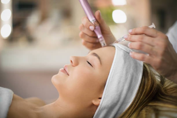 Best Microneedling Treatment in Phoenix