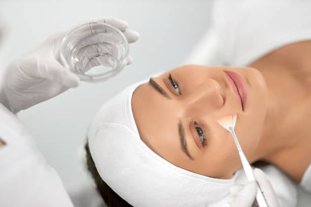 Chemical Peels for Dull Skin