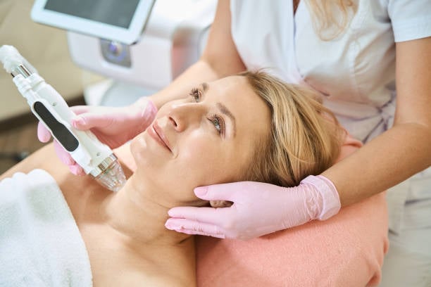 RF Microneedling Treatment