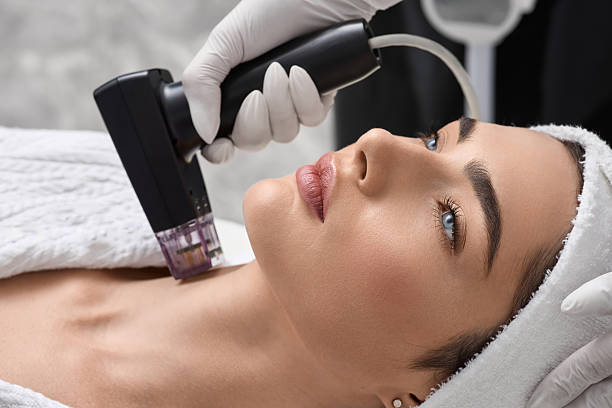 RF Microneedling Worth It After